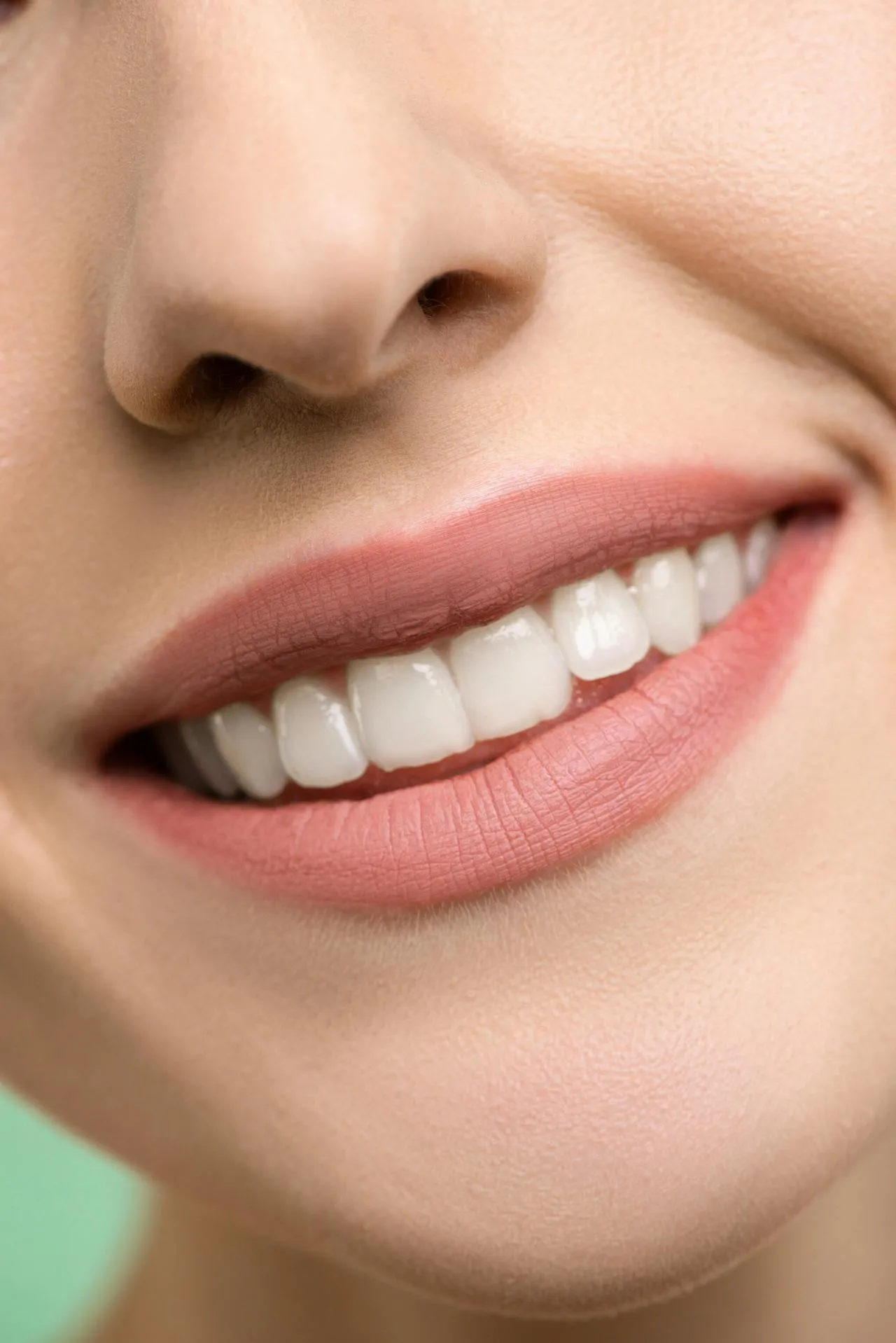 Stunning Hollywood Smile result — perfectly aligned, bright white teeth after cosmetic dental treatment in Turkey, the kind of result achieved at Taki Dent Antalya