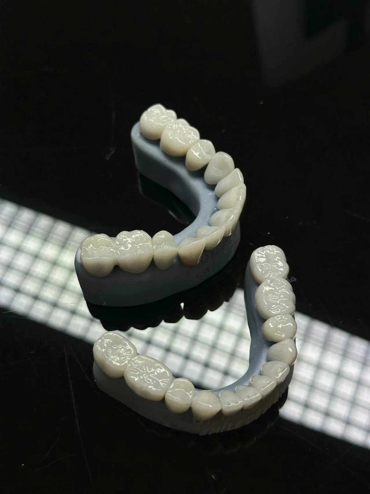 Ultra-thin porcelain veneer shells displayed before fitting — E-max ceramic veneers showing the translucent, lifelike quality used in Hollywood Smile makeovers